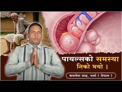 पाईल्सको समस्या निको भयो । कमलेश शाह ,पर्सा । Sant Rampal Ji Nepali Satsang