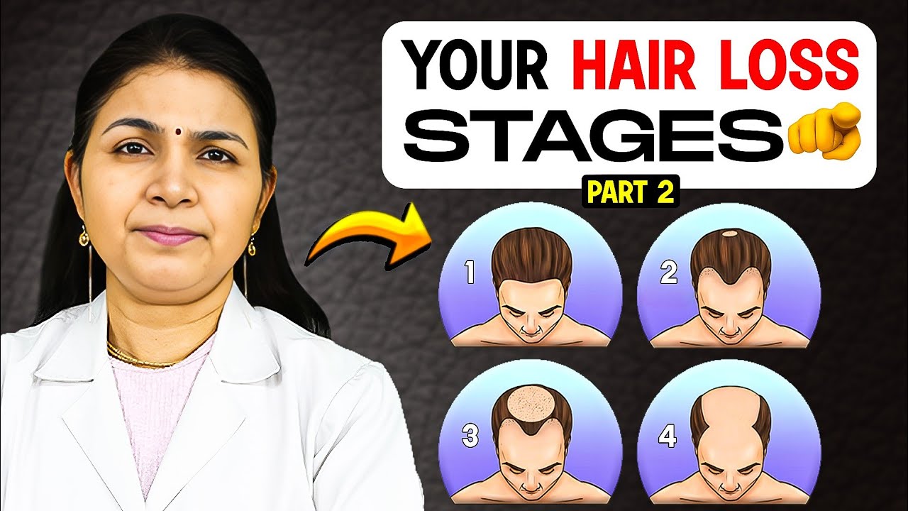 Your Hair Loss Grade - is Hair Transplant the Right Treatment for YOU?