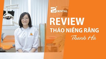 [Review niềng răng]: #10 Kết quả niềng răng của Thanh Hà