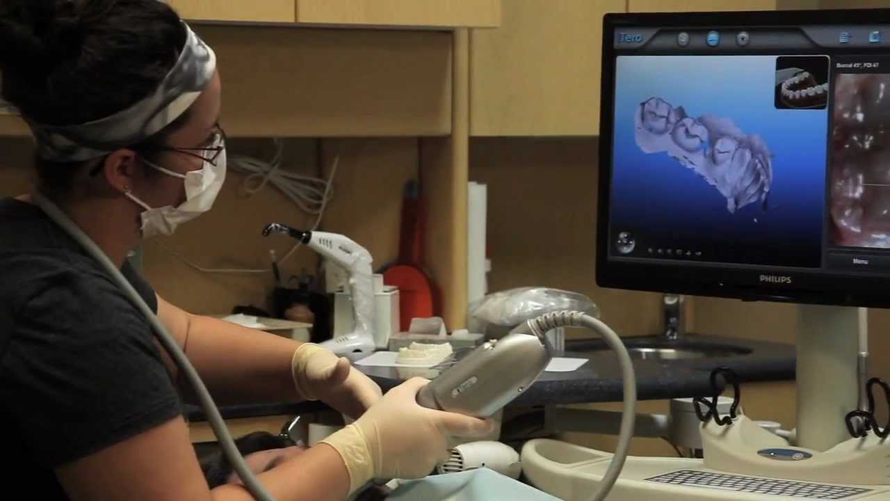 Winnipeg Dentist Why We Use Digital Imaging Instead of Impressions