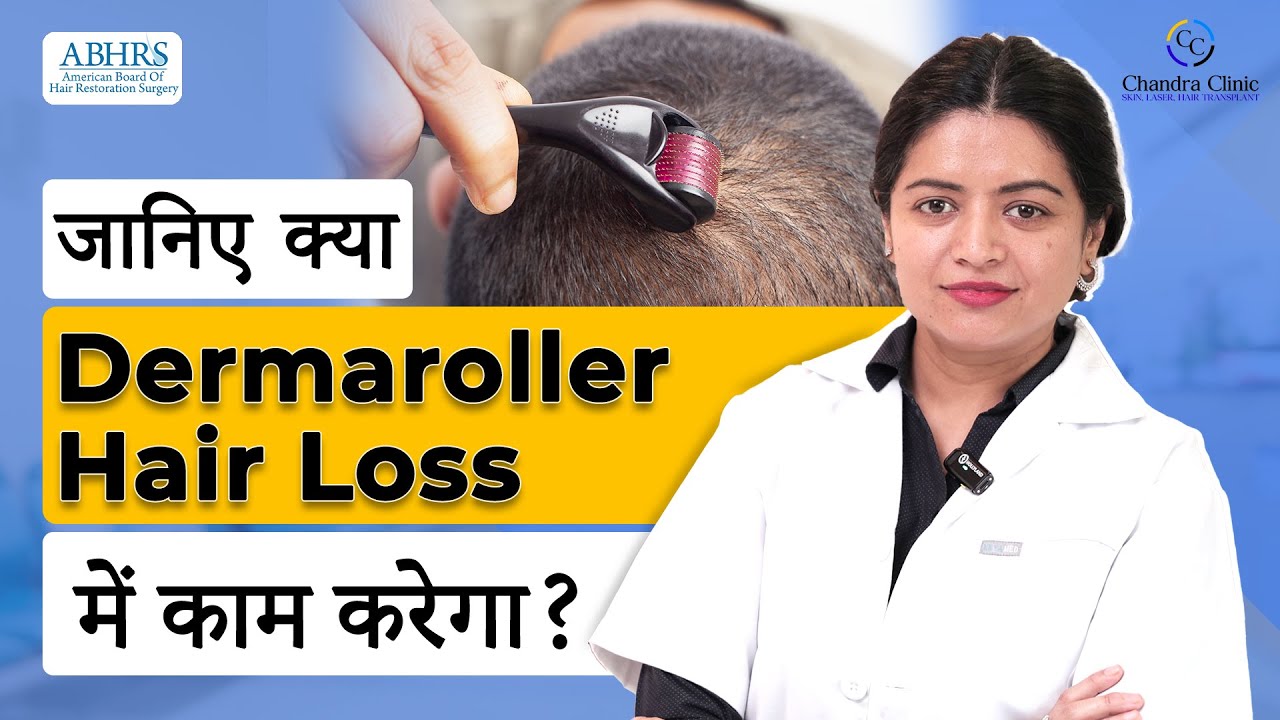 Dermaroller for Hair Loss Best Hair Fall Doctor in Delhi Dr