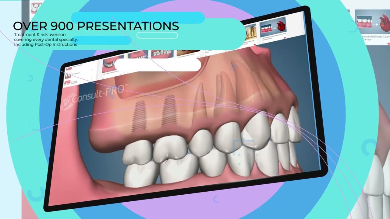Consult-PRO: Software For Dentists | Case Presenter | Patient Education Web Application