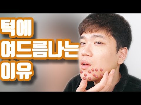 남자 턱에 여드름 나는 이유,원인 - Youtube