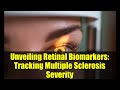 Unveiling Retinal Biomarkers: Tracking Multiple Sclerosis Severity