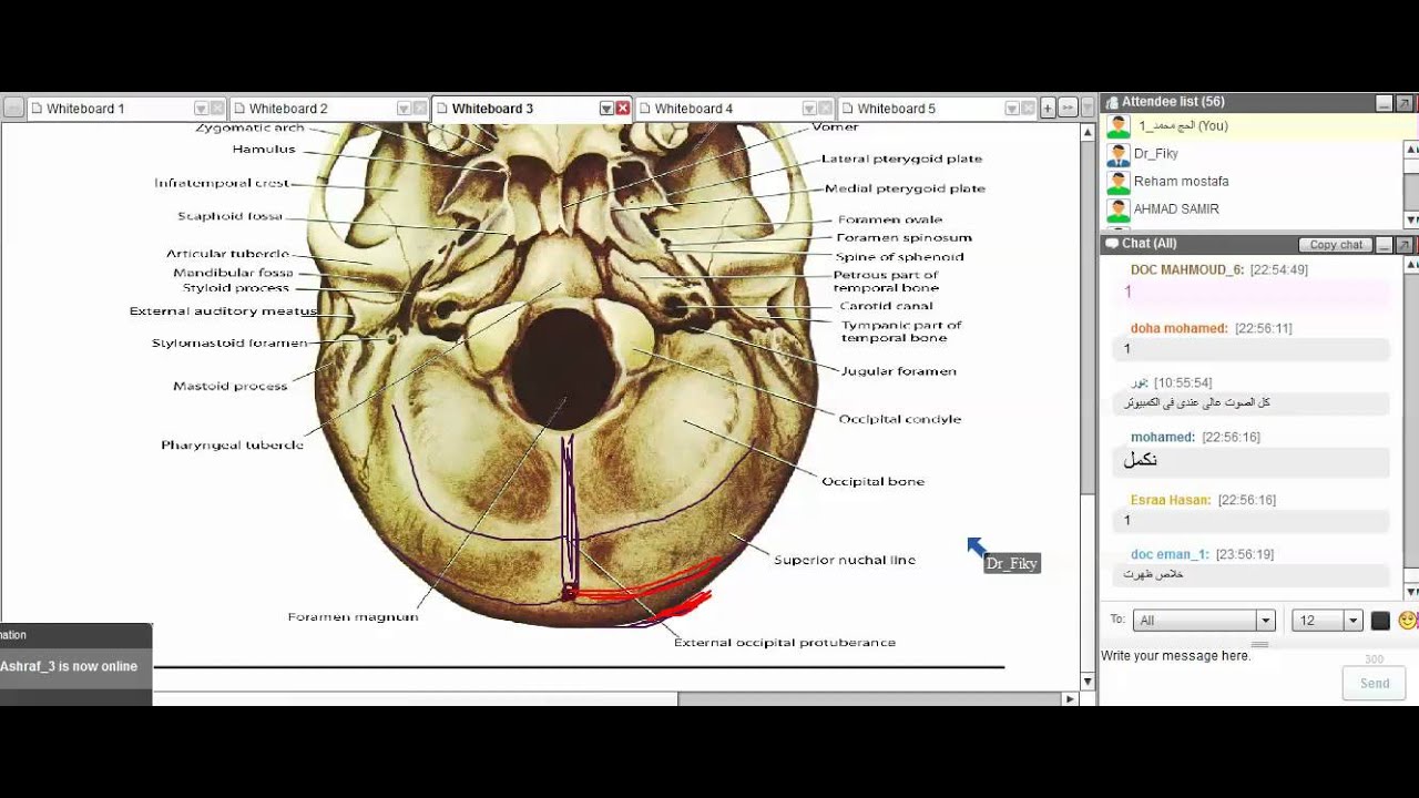 مراجعه عملي Head and Neck bone) د_محمد الفقي - YouTube