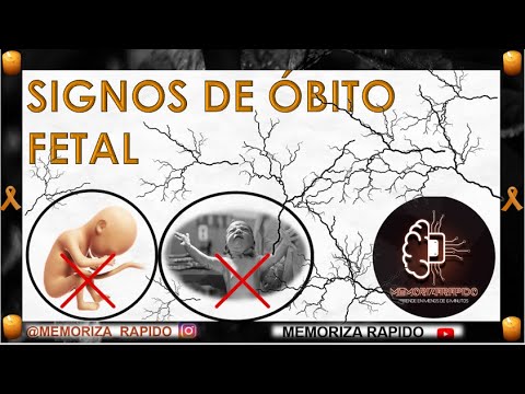 SIGNOS DE OBITO FETAL #obito #obitouchiha #abortoseguro - YouTube