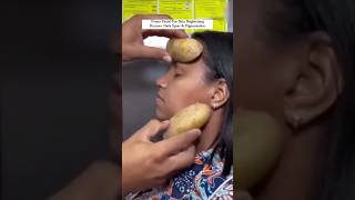 Potato Facial For Skin Brightening | Remove Dark Spots & Pigmentation #shorts #skincare