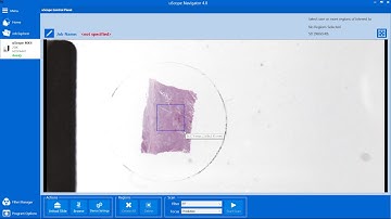 Using the Exhaustive Stack Focus Method