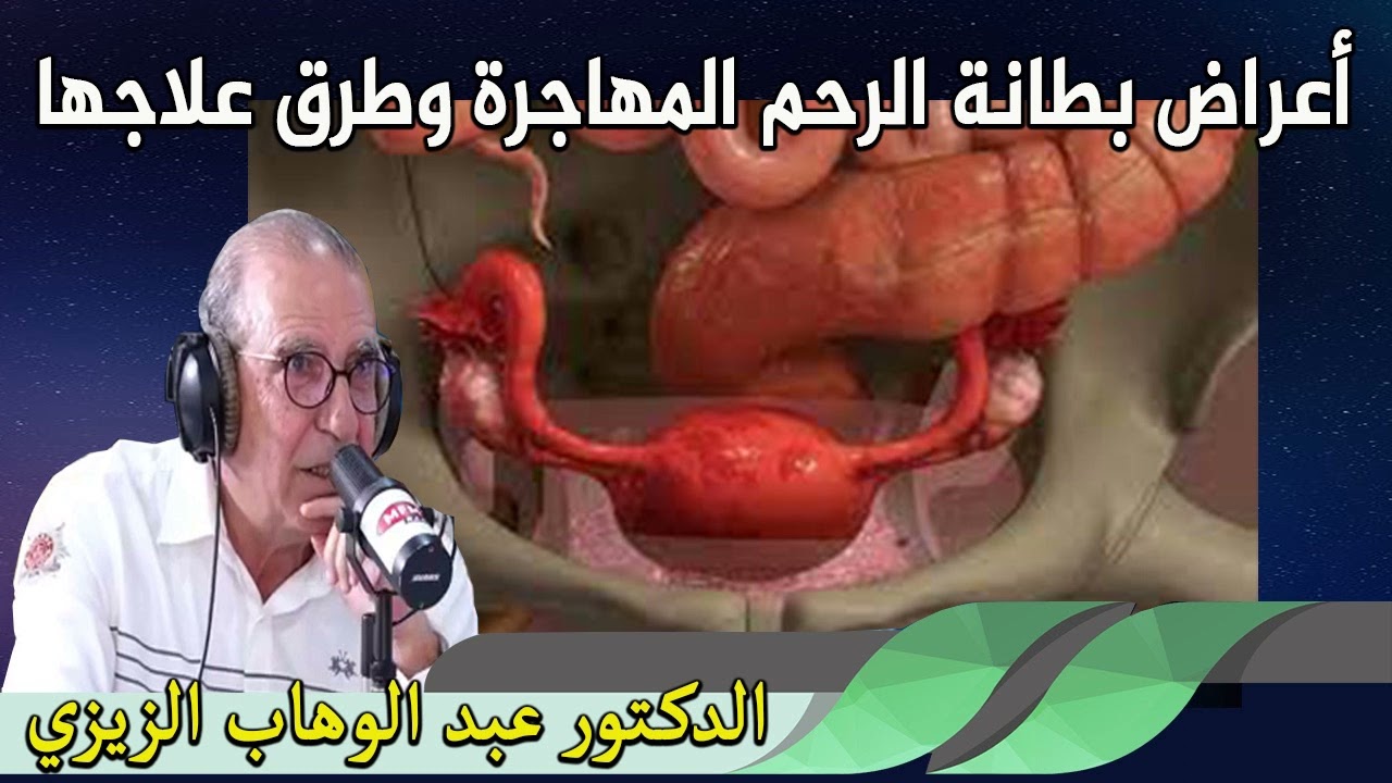أعراض بطانة الرحم المهاجرة‏ وطرق علاجها  الدكتور عبد الوهاب زيزي