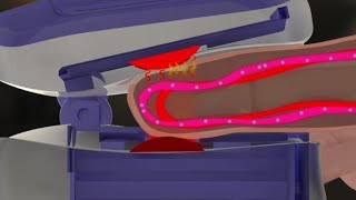 El oxímetro de pulso | AFP Animé screenshot 1