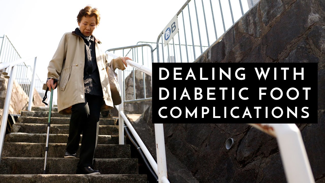 Diabetic Foot Complications and Charcot Foot – Podiatrist Georgina Tay, East Coast Podiatry