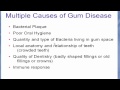 Where Gum Disease comes from and how to prevent it