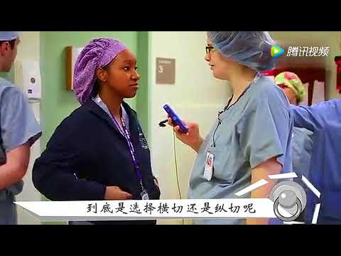 剖腹产