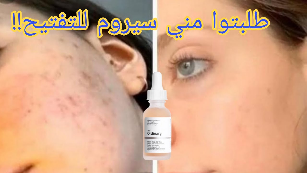 أفضل تقشير لتفتيح البشرة و تقشير محيط العين/ٱمن للمرضع و ٱمن بالصيف/ تجربتي