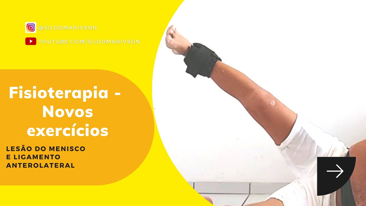 LesÃo No Menisco Em AlÇa De Balde Ligamento Anterolateral VÍdeo 14 