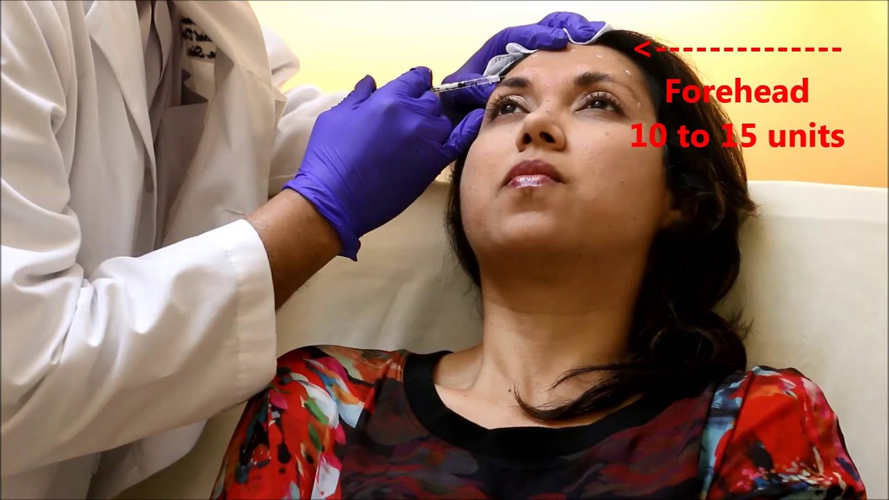 Best Botox Injections in NJ YouTube