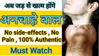 How to remove unwanted hairs permanently | anchahe baal hatane ke tarike |  facial Hair remove