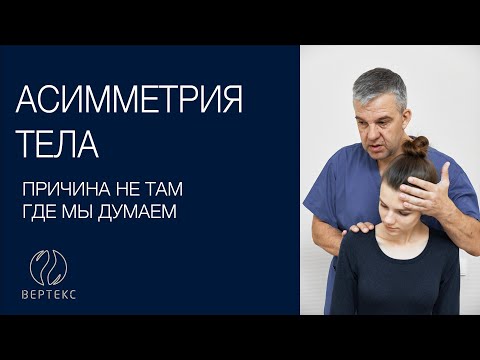 Асимметрия Тела. Причины. Лечение