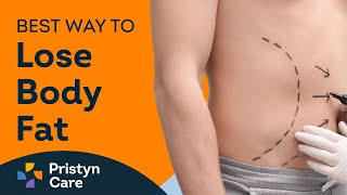 Liposuction for Fat Loss | Best Way To Lose Body Fat