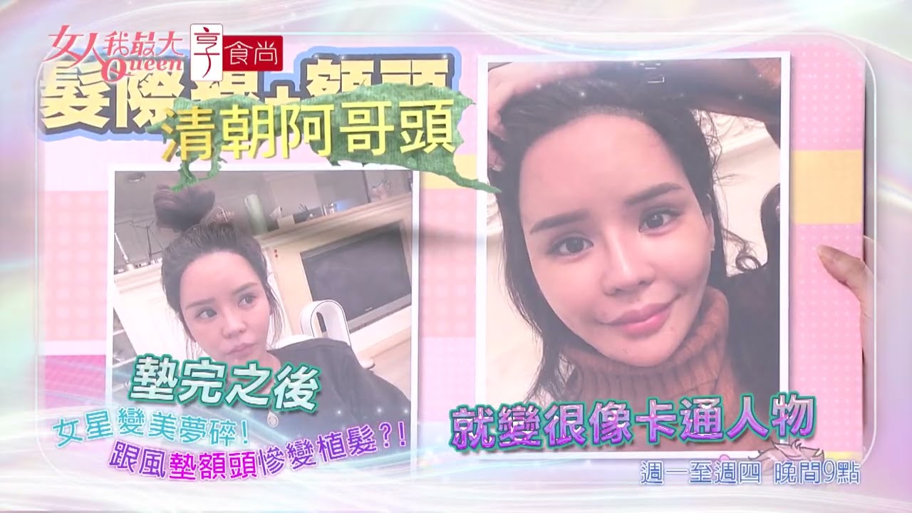 變美夢碎！女星親身血淚教訓 #女人我最大 20251027(預告)