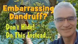 Simple remedy for embarrassing dandruff and itchy scalp.