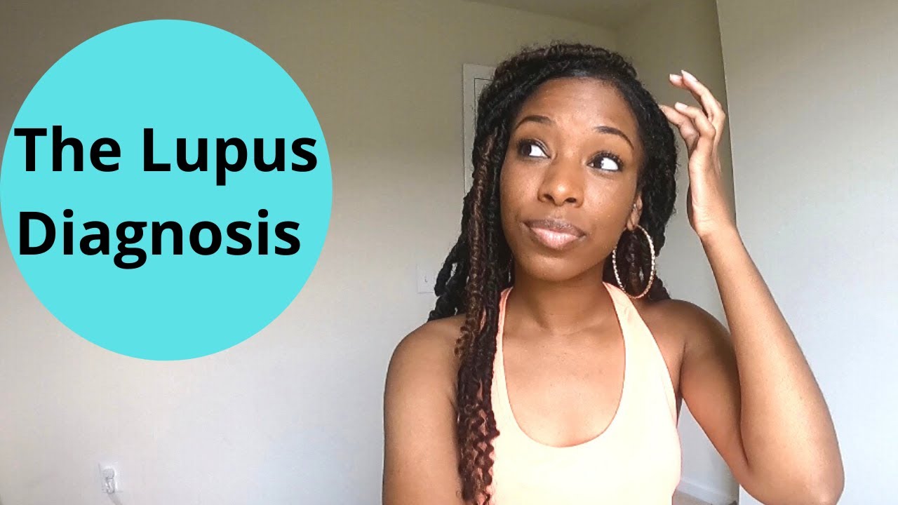 Lupus Diagnosis Video - Signs and Symptoms