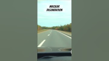 Symptoms of Macular Degeneration