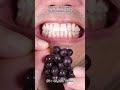 Satisfying Chewing ASMR #Compilation #ASMR #DoctorTristanPeh