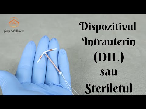S2.Ep5 - DIU - Steriletul - Dispozitivul intrauterin - Contraceptie nehormonală de termen lung
