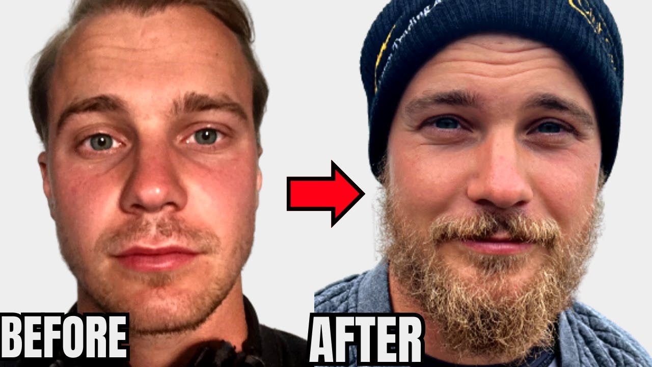 ЕДИНСТВЕННЫЙ совет, который вам нужен, чтобы отрастить бороду
