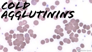 Cold Agglutinins on Peripheral Blood Smear