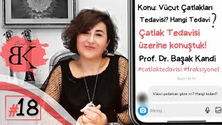 Prof. Dr. Başak Kandi. Merak Edilenler Serisi Vücut Çatlakları? Tedavisi? Fraksiyonel Lazer?