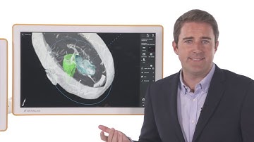 Brainlab Microscope Navigation with Leica ARveo