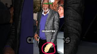 5 Celebrities with Physical Disabilities #shorts