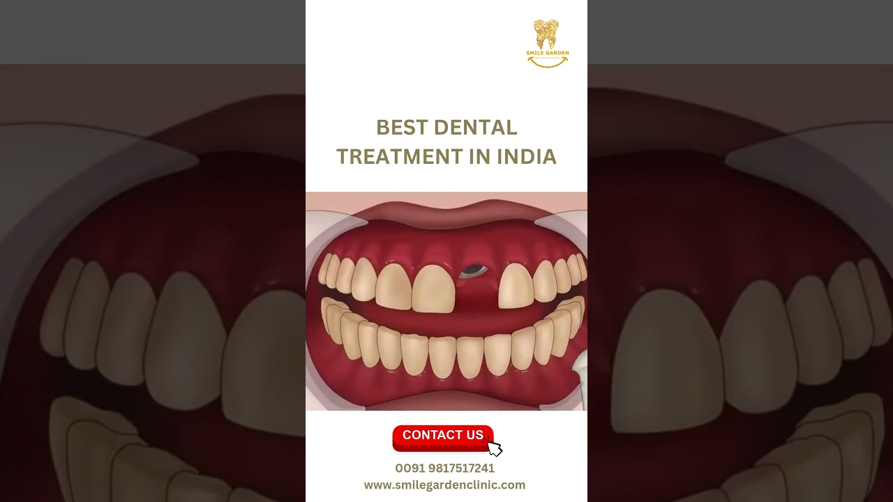 Best Dental Treatment in India