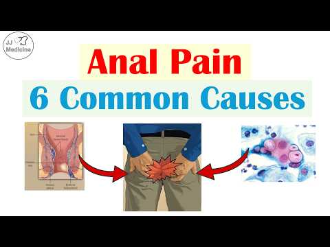 6 Common Causes of Anal (Rectal) Pain That You Should Know