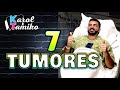Juan Manuel Cortes de Suelta la Sopa con 7 tumores entérate que pasara