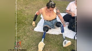 The beautiful woman with amputated legs and arms, life in prosthetic limbs #amputee