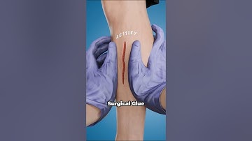 How Surgical Glue Works 😨
