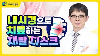 디스크보다 더 무서운 디스크 재발! 내시경으로 드디어 완치?!