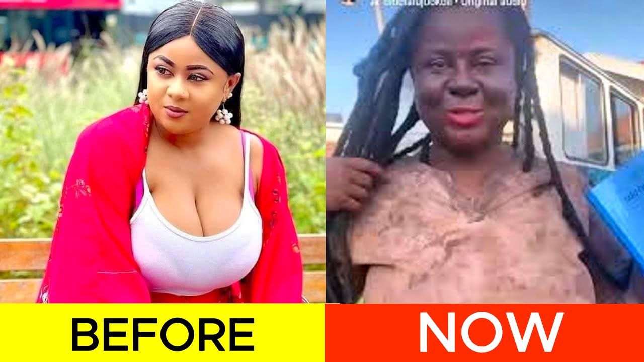 18 Nollywood Actors With Mental Health Issues