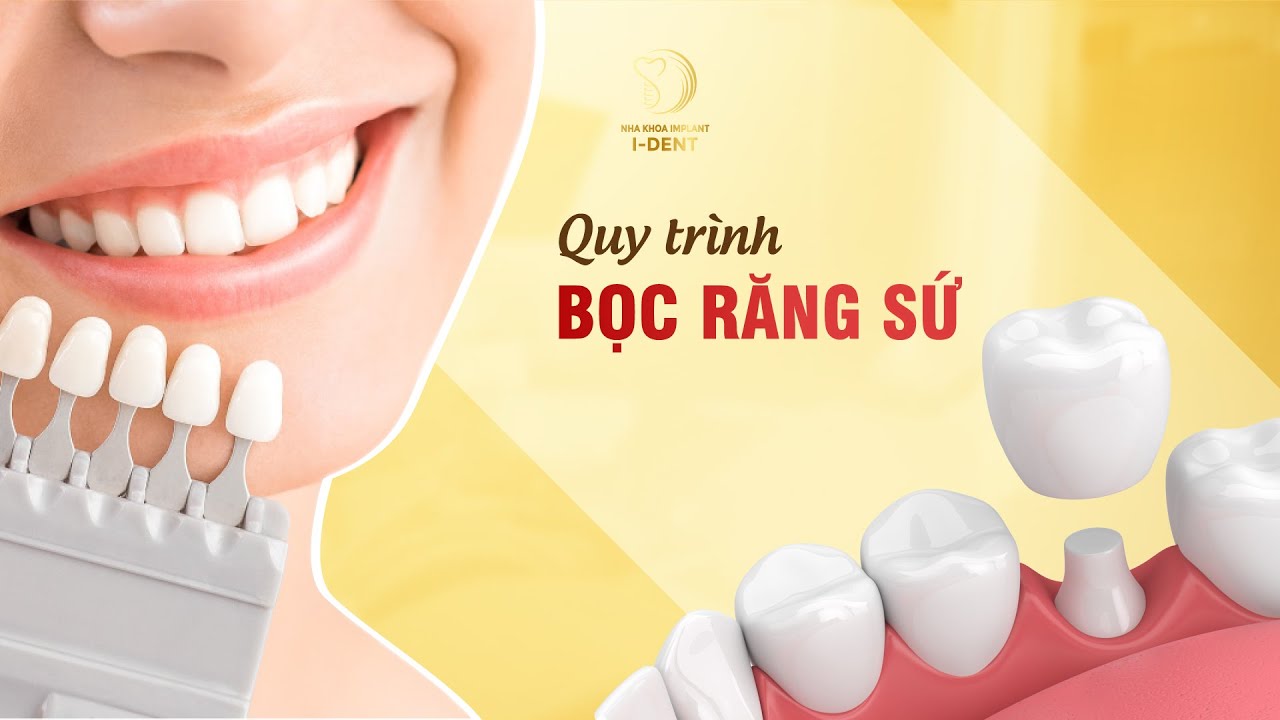 QUY TRÌNH GẮN RĂNG SỨ CÔNG NGHỆ MỚI | NHA KHOA I-DENT