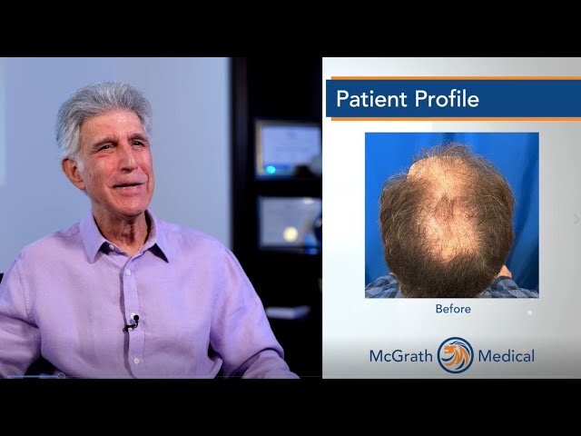 Age should not be a factor in having a hair transplant - Austin, Texas