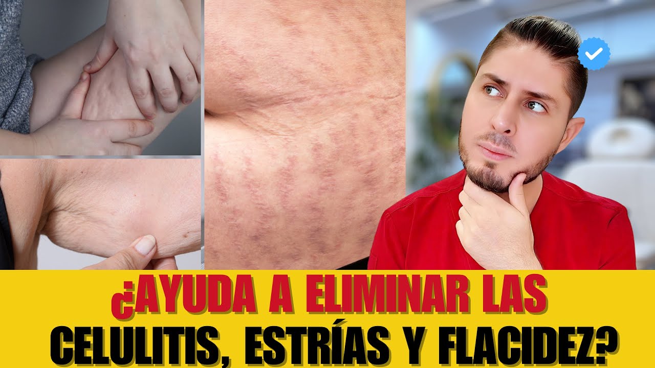 CARBOXITERAPIA DESCUBRE TODOS SUS BENEFICIOS| DOCTOR LEMUS