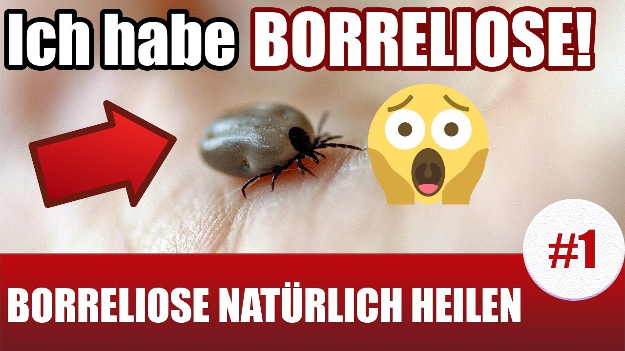 Ich habe Borreliose!!! (Borreliose Behandlung natürlich #1) - YouTube
