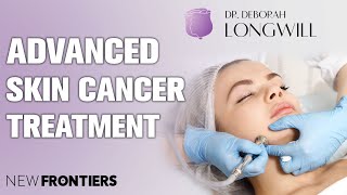Miami Center for Dermatology in Advanced Treatment for Skin Cancer 1 Minute Version