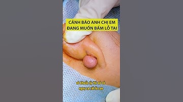 Hậu quả kinh hoàng bấm lỗ tai | Bác Sỹ Tuấn Dương #shorts