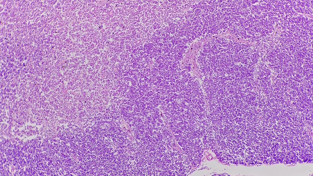 Thymus in transversal section magnified under microscope in 200 times