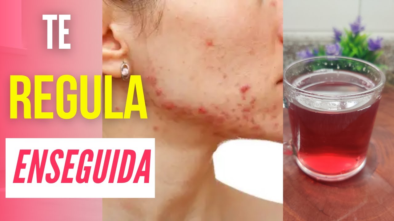 Cómo se REGULAN las HORMONAS Femeninas/Qué es Bueno para Regular las Hormonas en la MUJER