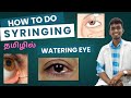 How to do Lacrimal Syringing | Watery eyes treatment | Treatment for watering eyes#eyeexercise Tamil